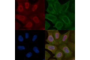 SENP2 Mouse Monoclonal Antibody staining Hela cells by IF/ICC.
