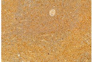 ABIN6264594 and ABIN6279749 at 1/100 staining Rat spleen tissue by IHC-P. (RAB9B 抗体  (Internal Region))