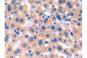 Immunohistochemistry (IHC) image for anti-Notch 1 (NOTCH1) (AA 1919-2079) antibody (ABIN7445663)