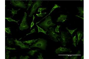 Immunofluorescence of monoclonal antibody to TAP1 on HeLa cell. (TAP1 抗体  (AA 241-350))