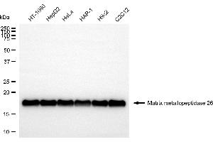 Western blotting analysis using matrix metallopeptidase 26 antibody (ABIN7799341).