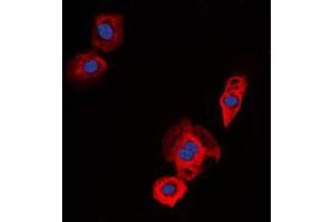 Immunofluorescent analysis of EGFR staining in Jurkat cells. (EGFR 抗体  (C-Term))
