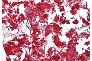 Rabbit Anti-RAPGEF2 antibody  Formalin Fixed Paraffin Embedded Tissue: Human Adrenal Primary antibody Concentration: 1:100 Secondary Antibody: Donkey anti-Rabbit-Cy3 Secondary Antibody Concentration: 1:200 Magnification: 20x Exposure Time: 0. (RAPGEF2 抗体  (C-Term))