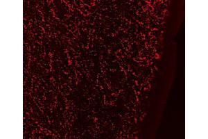 ABIN571062 (0. (GAL 抗体  (Internal Region))