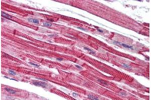 Human Heart (formalin-fixed, paraffin-embedded) stained with LPAR3 antibody ABIN768695 at 5 ug/ml followed by biotinylated goat anti-rabbit IgG secondary antibody ABIN481713, alkaline phosphatase-streptavidin and chromogen. (LPAR3 抗体  (AA 1-12))
