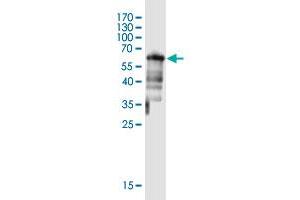 Western Blot detection against Immunogen (61. (DTWD1 抗体  (AA 1-304))