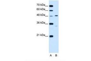 Image no. 2 for anti-Carbohydrate (Keratan Sulfate Gal-6) Sulfotransferase 1 (CHST1) (AA 74-123) antibody (ABIN320945)