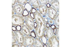 Immunohistochemistry of paraffin-embedded rat kidney using IP6K1 Rabbit pAb (ABIN6131922, ABIN6142500, ABIN6142501 and ABIN6215821) at dilution of 1:100 (40x lens). (IP6K1 抗体  (AA 1-220))