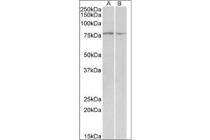 <strong>Western blot analysis:</strong> DAG1 antibody staining of Mouse and Rat Skeletal Muscle lysate at 0. (Dystroglycan 抗体  (Internal Region))