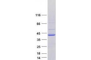 Western Blotting (WB) image for ATPase, H+ Transporting, Lysosomal 38kDa, V0 Subunit D2 (ATP6V0D2) protein (Myc-DYKDDDDK Tag) (ABIN2715053)