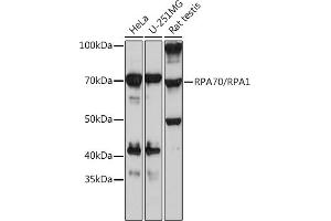 Western blot analysis of extracts of various cell lines, using RP/RP Rabbit mAb (ABIN7269915) at 1:1000 dilution. (RPA1 抗体)
