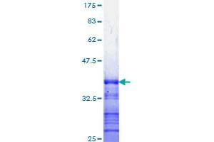 Image no. 1 for Nuclear Factor of kappa Light Polypeptide Gene Enhancer in B-Cells 1 (NFKB1) (AA 860-969) protein (GST tag) (ABIN1312485)