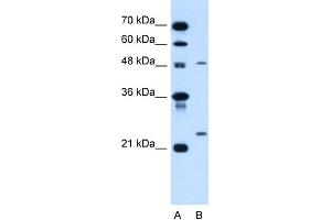 WB Suggested Anti-SMPD2 Antibody Titration:  1. (SMPD2 抗体  (N-Term))