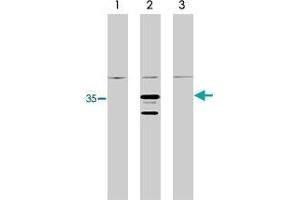 Western blot analysis using RIT1 monoclonal antibody, clone 14G7  on control 293 cells (lane 1), 293 cells expressing HA-tagged RIT1 protein (lane 2) and 293 cells expressing HA-tagged RIT2 protein (3). (RIT1 抗体)