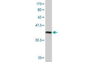 Western Blot detection against Immunogen (37. (ZEB2 抗体  (AA 1115-1214))