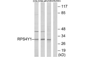 Western blot analysis of extracts from COLO cells, HeLa cells and HUVEC cells, using RPS4Y1 antibody. (RPS4Y1 抗体  (C-Term))