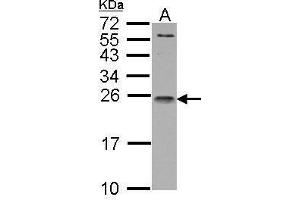 WB Image IL1 Receptor antagonist antibody detects IL1RN protein by Western blot analysis.