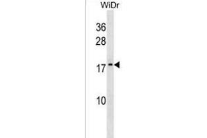 ATP5L2 Antibody (N-term) (ABIN1538885 and ABIN2850205) western blot analysis in WiDr cell line lysates (35 μg/lane). (ATP5L2 抗体  (N-Term))