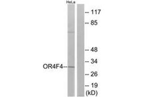 Western blot analysis of extracts from HeLa cells, using OR4F4 Antibody. (OR4F4 抗体  (AA 256-305))