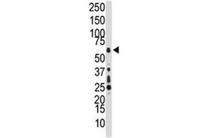 Western Blotting (WB) image for anti-Nuclear Receptor Subfamily 2, Group C, Member 2 (NR2C2) (AA 574-606) antibody (ABIN3032060)