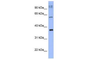 WB Suggested Anti-KCTD4 Antibody Titration:  0. (KCTD4 抗体  (N-Term))