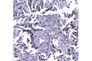 IHC analysis of MDC1 using anti-MDC1 antibody . (MDC1 抗体  (AA 534-626))