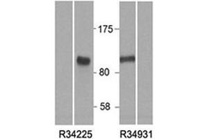 Western blot of HEK293 lysate overexpressing human HIC1 tested with HIC1 antibody at (0. (HIC1 抗体)