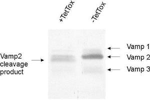 dilution: 1 : 1000, sample: crude synaptosomal fraction of rat brain (P2) (VAMP1, 2, 3 (AA 1-81) 抗体)