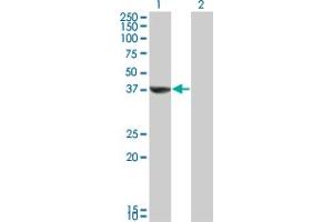 Western Blot analysis of TAF5L expression in transfected 293T cell line by TAF5L monoclonal antibody (M01A), clone 1C5. (TAF5L 抗体  (AA 1-117))