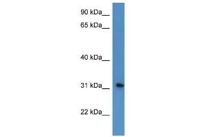 Western Blot showing ROPN1L antibody used at a concentration of 1-2 ug/ml to detect its target protein. (ROPN1L 抗体  (N-Term))