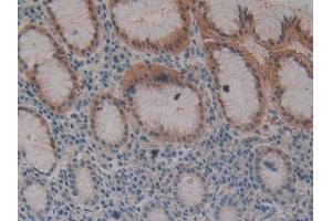DAB staining on IHC-P; Samples: Human Stomach Tissue (Fibrillin 3 抗体  (AA 403-667))