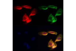 ABIN7094202 and ABIN7098248 staining Hela cells by IF/ICC. (ERGIC2 抗体  (C-Term))