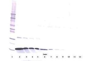 Image no. 1 for anti-Interferon gamma (IFNG) antibody (ABIN465161)
