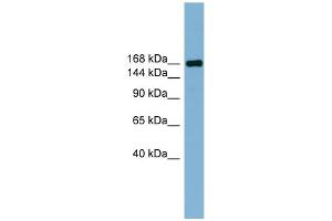 WB Suggested Anti-PARD3 Antibody Titration:  0. (PARD3 抗体  (Middle Region))