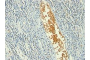Formalin-fixed, paraffin-embedded human Tonsil stained with AMPD3 Mouse Monoclonal Antibody (AMPD3/901) (AMPD3 抗体)