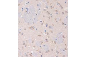 Immunohistochemistry of paraffin-embedded Mouse brain using STIM2 Rabbit pAb (ABIN7270611) at dilution of 1:100 (40x lens). (Stim2 抗体  (AA 60-180))
