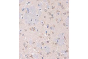 Immunohistochemistry of paraffin-embedded Mouse brain using STIM2 Rabbit pAb (ABIN7270611) at dilution of 1:100 (40x lens).