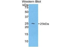 Western Blotting (WB) image for anti-Hemoglobin beta (HBB) (AA 1-145) antibody (ABIN1175990) (Hemoglobin Subunit beta 抗体  (AA 1-145))