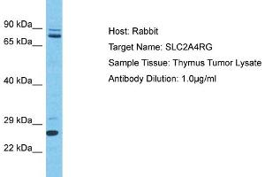 Host: Rabbit Target Name: SLC2A4RG Sample Type: Thymus Tumor lysates Antibody Dilution: 1. (SLC2A4RG 抗体  (C-Term))