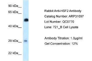 WB Suggested Anti-HSF2 Antibody   Titration: 1. (HSF2 抗体  (N-Term))
