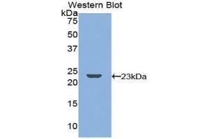 Detection of Recombinant RANk, Mouse using Polyclonal Antibody to Receptor Activator Of Nuclear Factor Kappa B (RANk) (TNFRSF11A 抗体  (AA 359-542))