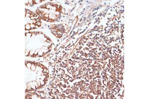 Immunohistochemistry (IHC) image for anti-Vasodilator-Stimulated phosphoprotein (VASP) (pSer157) antibody (ABIN6136286)