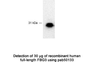 Image no. 1 for anti-F-Box Protein 44 (FBXO44) (C-Term) antibody (ABIN363442) (FBXO44 抗体  (C-Term))