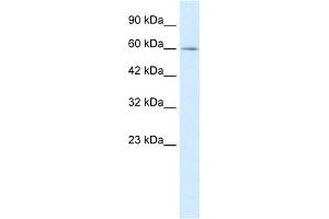 WB Suggested Anti-MYEF2 Antibody Titration:  0. (MYEF2 抗体  (Middle Region))