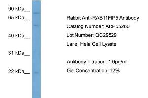 WB Suggested Anti-RAB11FIP5  Antibody Titration: 0. (RAB11FIP5 抗体  (N-Term))
