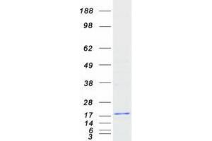 Synaptojanin 2 Binding Protein (SYNJ2BP) protein (Myc-DYKDDDDK Tag)