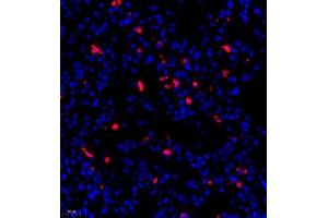 Immunofluorescence of paraffin embedded rat lung using PTPN2 (ABIN7075295) at dilution of 1:500 (400x lens)