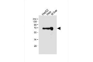 All lanes : Anti-ALB Antibody (C-term) at 1:1000 dilution Lane 1: HepG2 whole cell lysate Lane 2: Hela whole cell lysate Lane 3: Mouse liver tissue lysate Lysates/proteins at 20 μg per lane.