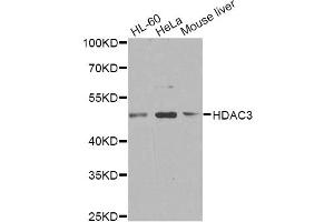 Western blot analysis of extracts of various cell lines, using HDAC3 antibody. (HDAC3 抗体)