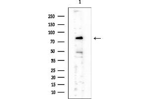 Western blot analysis of lysates from HUVEC cells, using CYP26B1 Mouse Monoclonal Antibody at 1/1000 dilution.